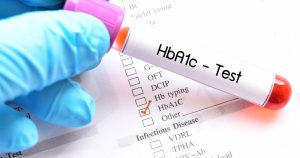 HbA1c Test